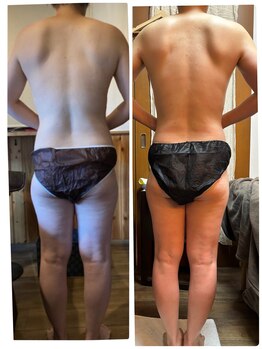 ハーモニー(Harmony)/肩の厚み改善憧れの華奢見えに☆