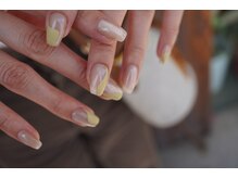 リム(Rim_)/マグネット × うねうね