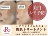 【美白・シミケア】ハーブピーリング＋贅沢オプション３種 ¥ 21,900