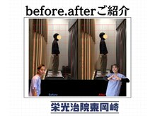 栄光治院 整体院東岡崎/慢性的だから諦めてませんか？