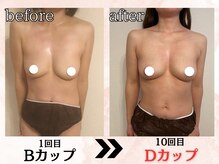 プリマ(prima)/バストアップ/３カップUP