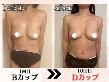 プリマ(prima)/バストアップ/3カップUP