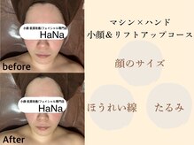 ハナ(HaNa)