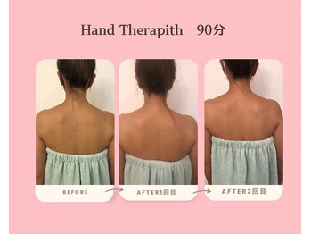 リビーナス(Re.venus)/肩甲骨周りの変化