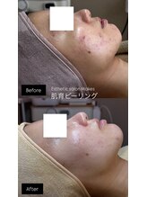 メイクス(Makes)/Before・After