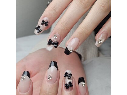 ビッキー(BIKKY)の写真