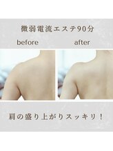 レポリア(Reporia)/肩こりで盛り上がった筋肉改善