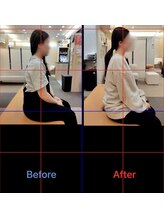 三ノ宮鍼灸院 接骨院/2か月整体　継続結果