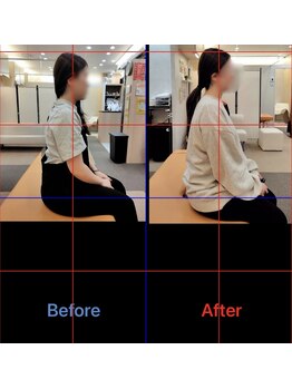 三ノ宮鍼灸院 接骨院/2か月整体　継続結果