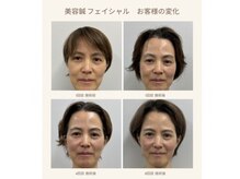トゥルーカラーズ