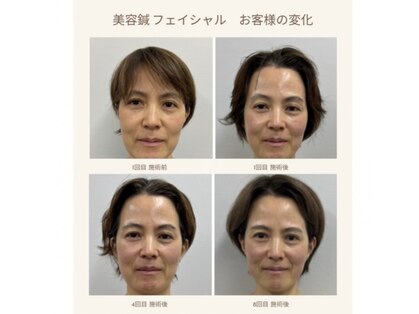 トゥルーカラーズの写真