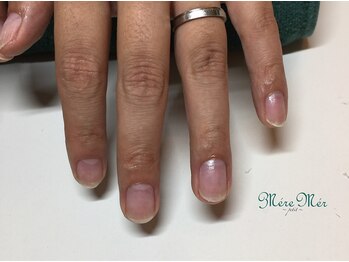 パラジェル認定サロン メールメール 池袋店(MereMer)/(卒業)115 深爪 深爪緩和 ケア　