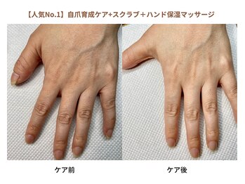 ココデネイル(cocode nail)/爪も肌も”うるつや”ケア♪