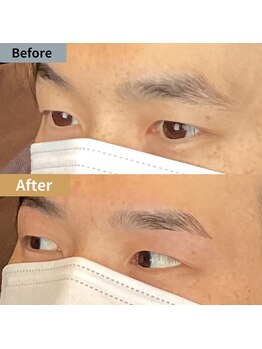 眉毛ハウス 吉祥寺店(眉毛HOUSE)/お客様の施術例(吉祥寺/東京)