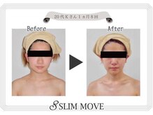 リリームーン 目黒店(Lily Moon)/痩身/スリムムーブ/目黒