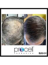 ヒルナム(Heal Nam)/プロセルセラピーズ　~頭皮~