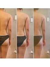 サプナジー(Suppnrgy)/カスタムトリートメント