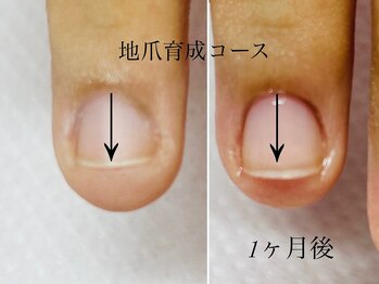 トゥインクリーネイルサロン(Twinkly Nail Salon)/【最強のネイルケア】1回お試し