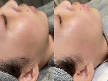 オパール 大阪梅田(op_l)/梅田/フェイスWAX/眉毛サロン/