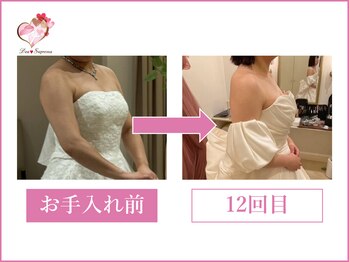 ディア スプリーマ/ブライダルエステ計14回