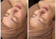 マミータ(Mamita)