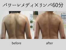 マーベル(MaaBelle)/パワーレメディ×リンパ60分