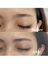 メンテ バイ イニシャル(Mente by initial)/eyebrow lift