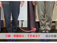 姿勢と体型のお悩みを改善！快適な毎日へ。根本から変わる整体院