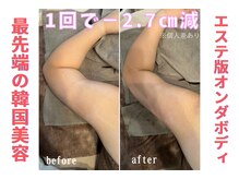 リリー(LILY)の雰囲気（オンダリフト/ハーブピーリング/ダーマペン/毛穴/小顔矯正/痩身）