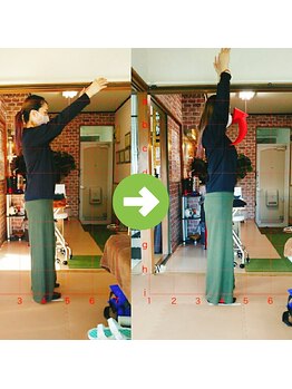 サプライズ整体院/20代ママさんの肩こり初回結果