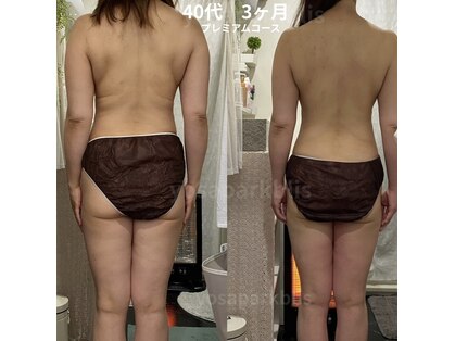 ヨサパーク ブリス(YOSA PARK blis)の写真