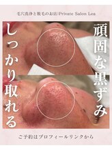 レア(Lea)/頑固な黒ずみもしっかり取れる＊