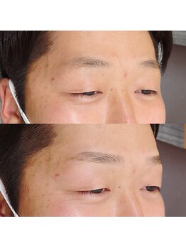 ミキ(MIKI)/【眉毛ワックス脱毛】