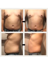 伊達男/フォースカッター 事例