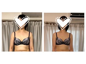 中目黒下半身ダイエット専門整体サロン/ビフォー(左) アフター(右)