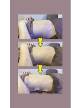 アムスパ(Aum Spa)/お腹周り脂肪分解液導入3回目