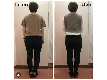 香里園かほりまち整骨院鍼灸院/産後骨盤矯正