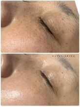 サロンドボーテ オランジュ(salon de beaute Orange)/ハーブトリートメント