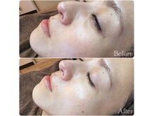 ジーンバイピエル 中野店(gene by PIEL)の雰囲気（お客様の美しさを引き出すお手伝いを私たちにお任せください）