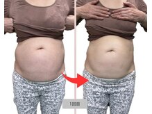 リセル(Recell)/お腹★脂肪分解