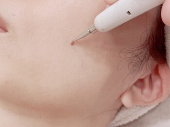 ビネージュ/シミケア