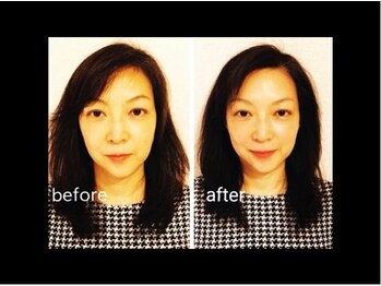 マシュマロヘッド 目黒店(Mashumaro Head)/本格顔深層筋小顔フェイシャル 