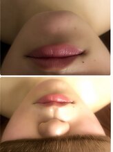 カルミア 心斎橋店/★レモンボトル一回での効果★