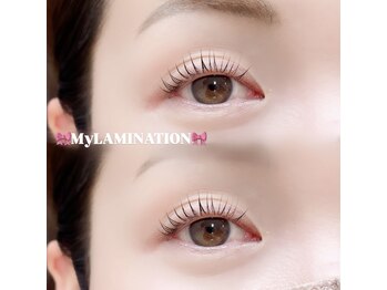 ビュー(V.I.E.W)/MyLAMINATION