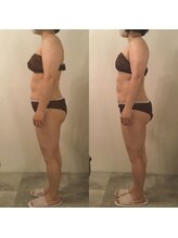 ピカケ(PIKAKE)/筋膜リリース