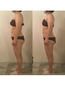 ピカケ(PIKAKE)/筋膜リリース