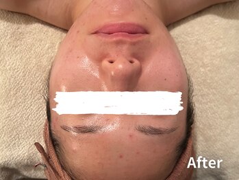 ダイヤモンド リーエンダ(Diamond leende)/クレイハーブピーリング