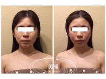 美極 銀座店/銀座/小顔コルギ/小顔矯正
