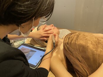 ラディアント 吉祥寺/細部まで丁寧にシミケア！