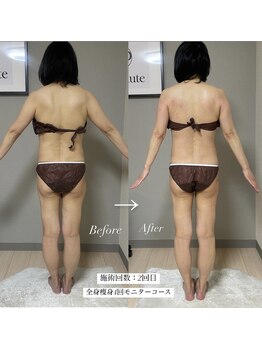 エヌボーテ(N. beaute)/全身痩身4回コース